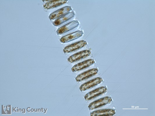Photo of Thalassiosira nordenskioeldii